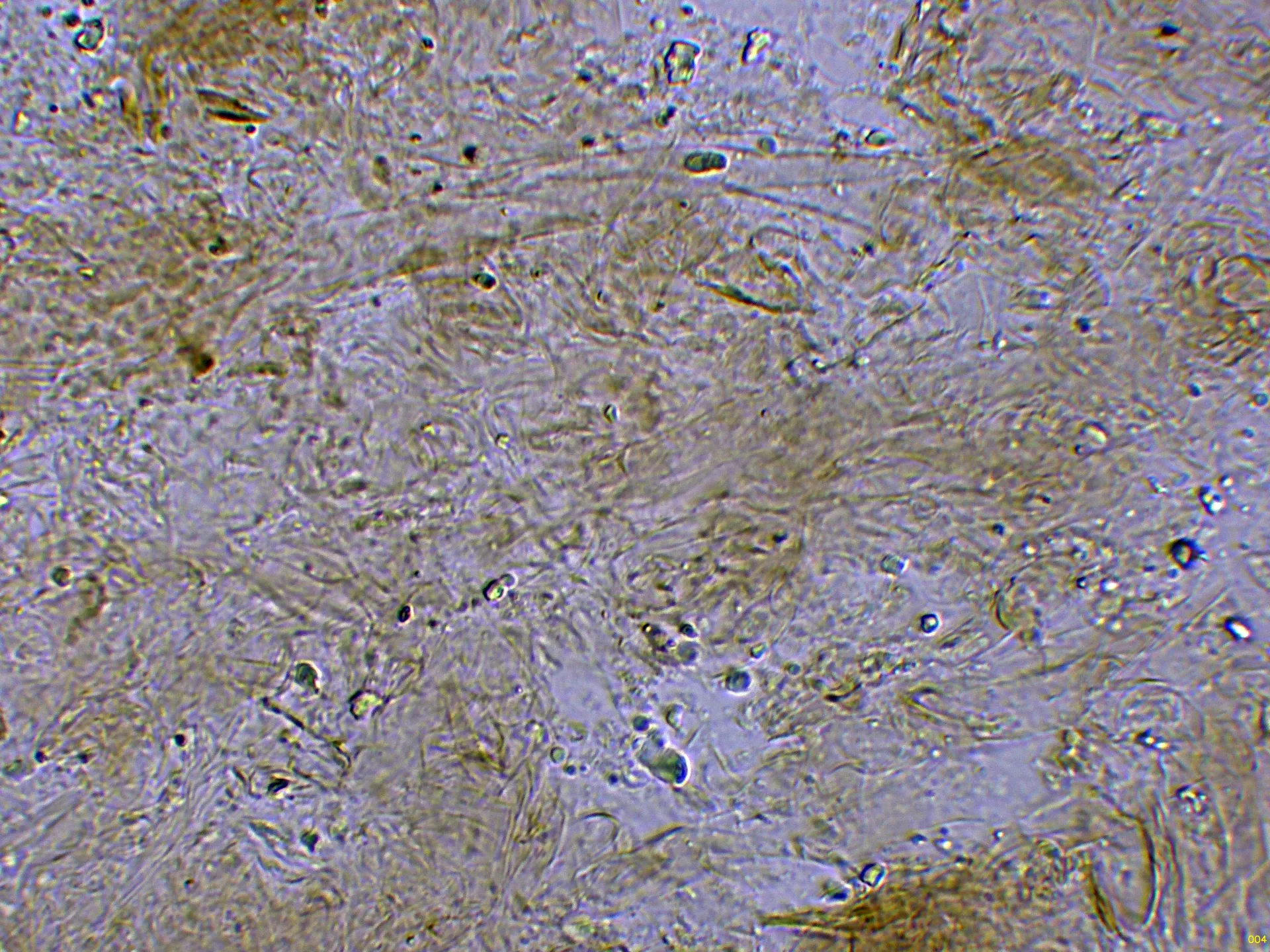 10 - Suprapellis agua-004